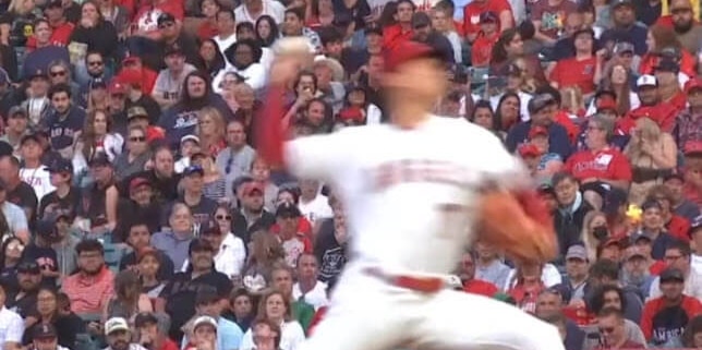 Arm Protective Sleeves For Baseball Youth Pitchers Safe? Can Kinetic Arm Help Provide Treatment To AVOID Tommy John Surgery OR Little League Shoulder?